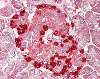 TSPYL2 Antibody in Immunohistochemistry (Paraffin) (IHC (P))