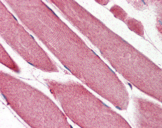 RNF92 Antibody in Immunohistochemistry (Paraffin) (IHC (P))