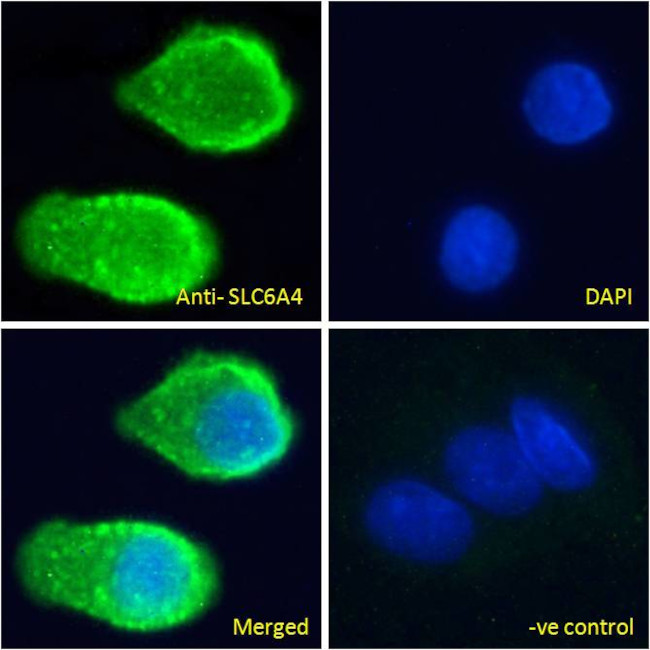 SLC6A4 Antibody in Immunocytochemistry (ICC/IF)