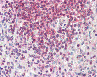 HMHA1 Antibody in Immunohistochemistry (Paraffin) (IHC (P))