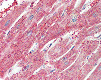 ARPC1A Antibody in Immunohistochemistry (Paraffin) (IHC (P))