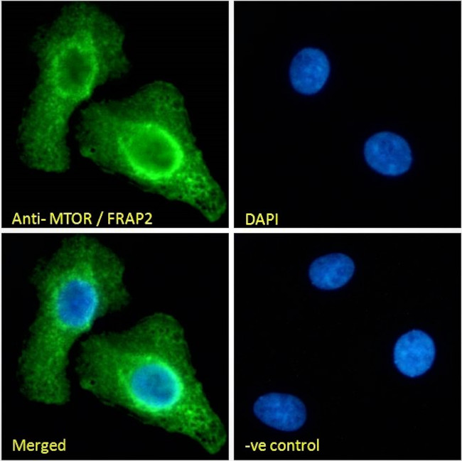 mTOR Antibody in Immunocytochemistry (ICC/IF)