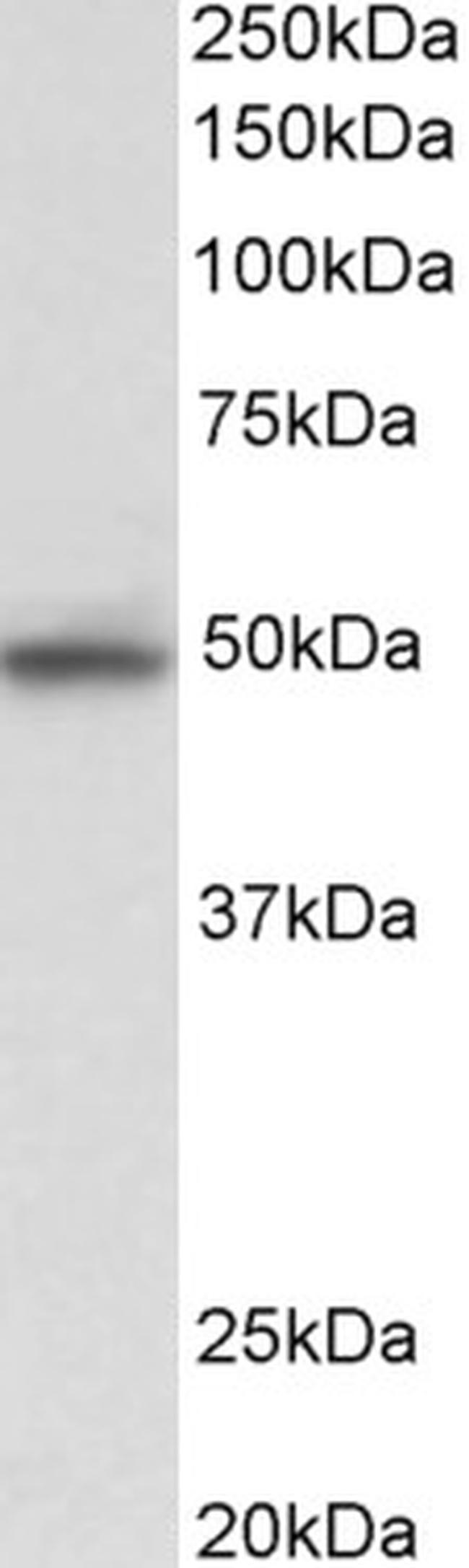 JNK2 Antibody in Western Blot (WB)
