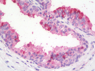 ZBTB24 Antibody in Immunohistochemistry (Paraffin) (IHC (P))