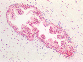 SOX9b Antibody in Immunohistochemistry (Paraffin) (IHC (P))