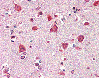 SDCCAG8 Antibody in Immunohistochemistry (Paraffin) (IHC (P))