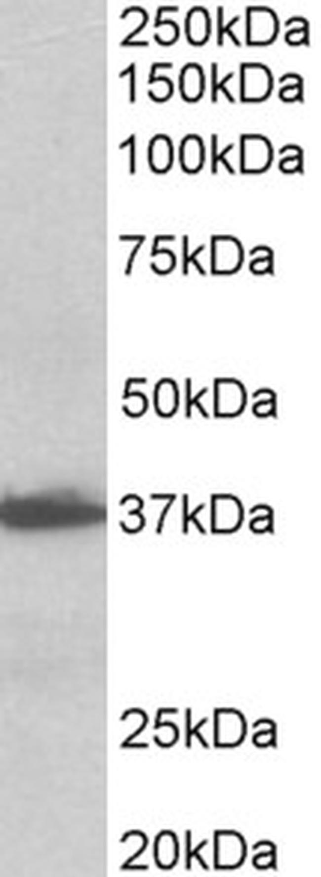 EMAP II Antibody in Western Blot (WB)