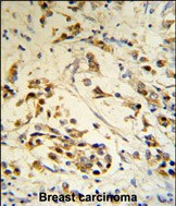 RBM3 Antibody in Immunohistochemistry (Paraffin) (IHC (P))