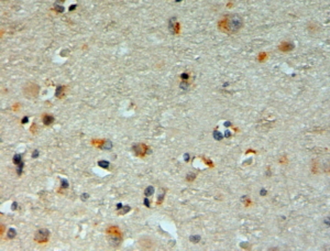 MIB1 Antibody in Immunohistochemistry (Paraffin) (IHC (P))