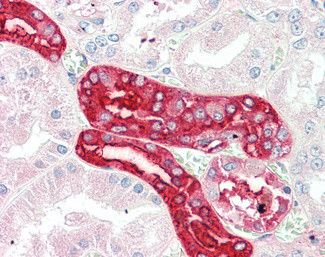 RKHD2 Antibody in Immunohistochemistry (Paraffin) (IHC (P))