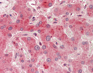 PRMT7 Antibody in Immunohistochemistry (Paraffin) (IHC (P))