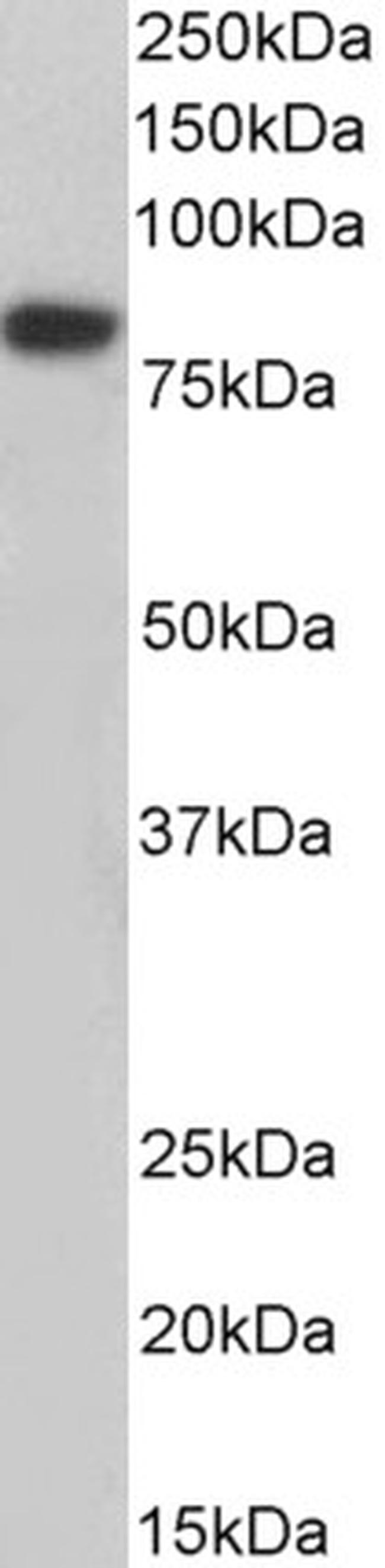 Coilin Antibody in Western Blot (WB)