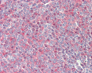 PKC beta Antibody in Immunohistochemistry (Paraffin) (IHC (P))