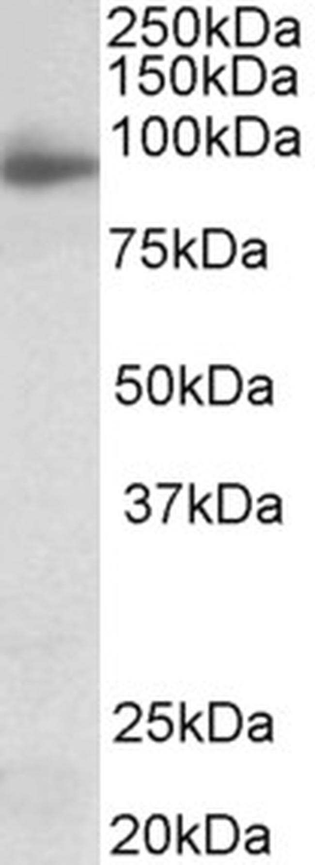 NLGN4X (Neuroligin-4) Antibody in Western Blot (WB)