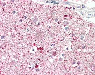 DGKQ Antibody in Immunohistochemistry (Paraffin) (IHC (P))