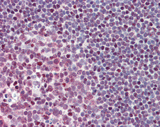 FUBP1 Antibody in Immunohistochemistry (Paraffin) (IHC (P))