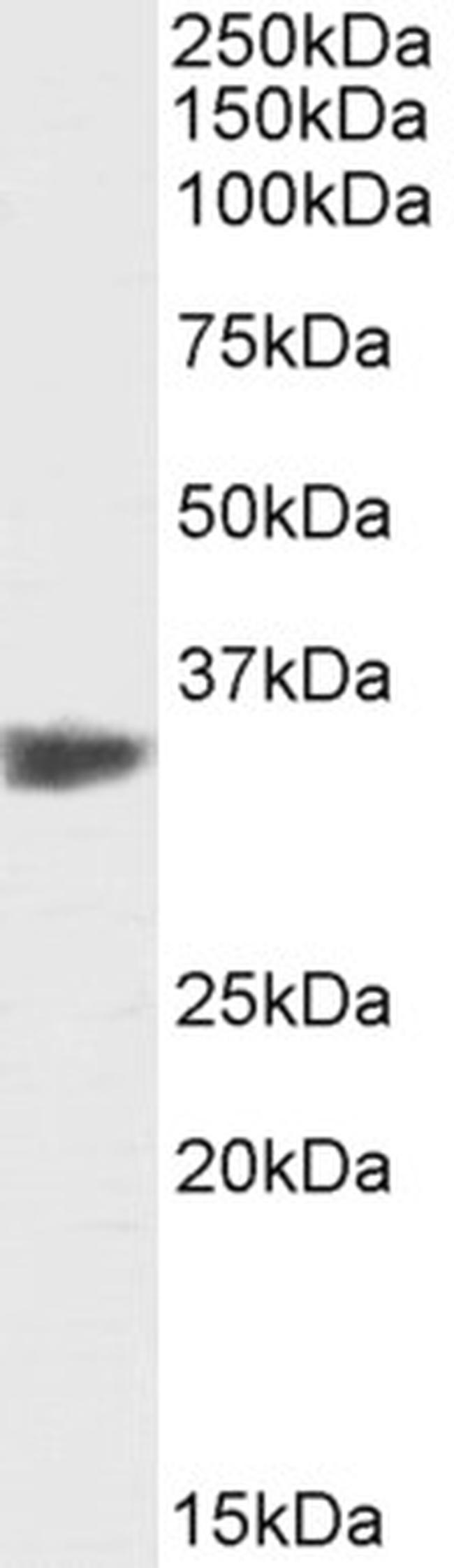 PCNA Antibody in Western Blot (WB)