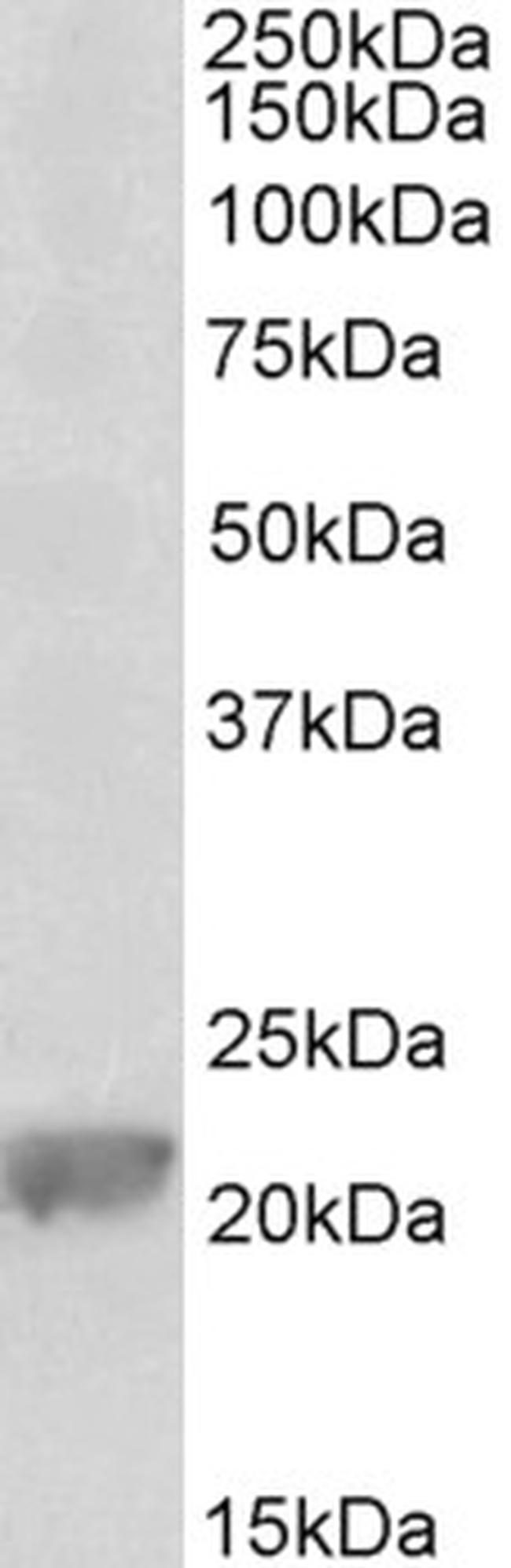 GPX1 Antibody in Western Blot (WB)