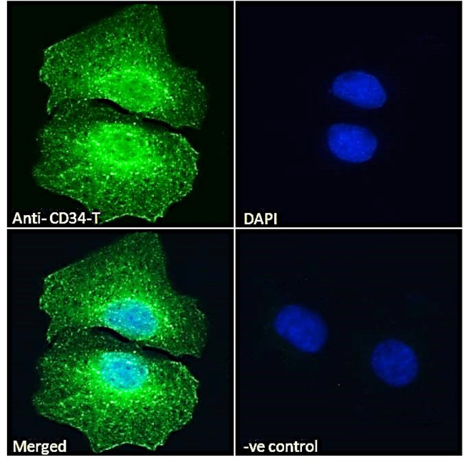 CD34-T Antibody in Immunocytochemistry (ICC/IF)