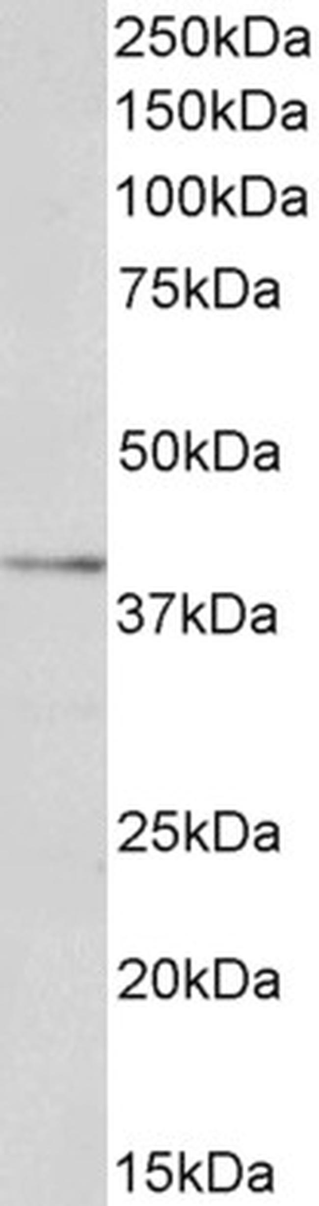 LOX-1 Antibody in Western Blot (WB)