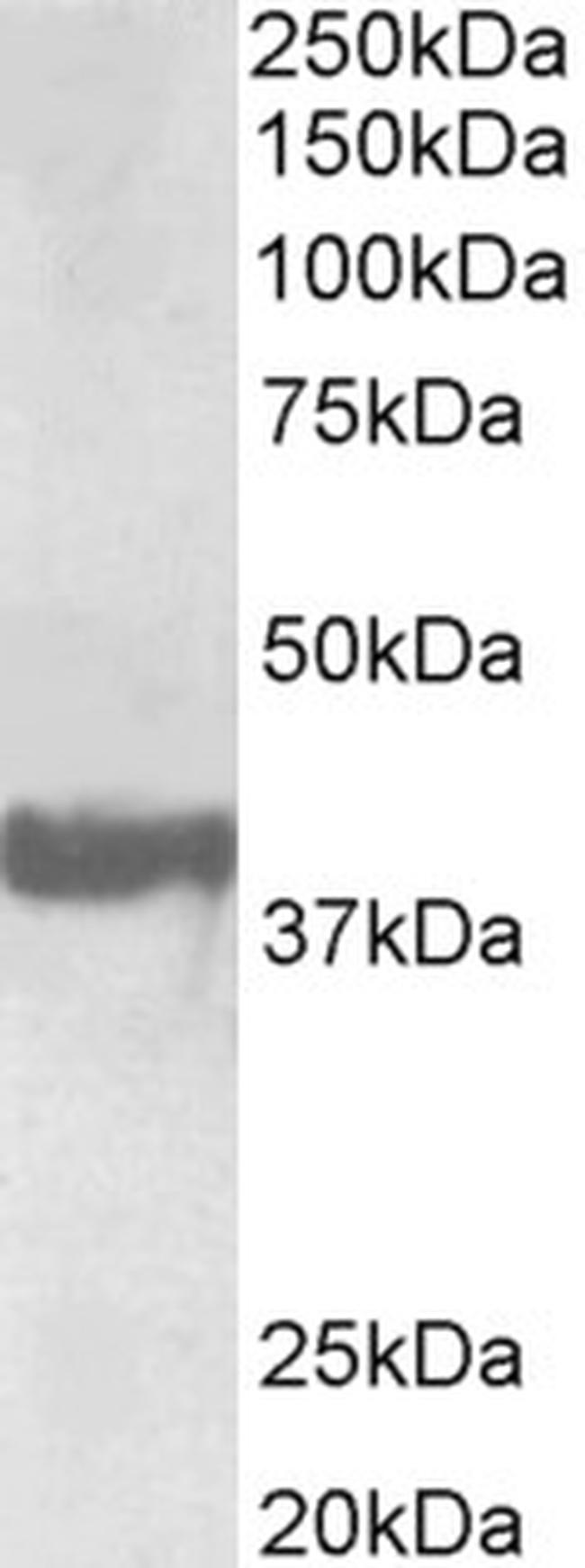 SH3GL2 Antibody in Western Blot (WB)