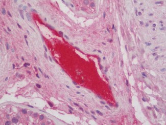 Complement C3 Antibody in Immunohistochemistry (Paraffin) (IHC (P))