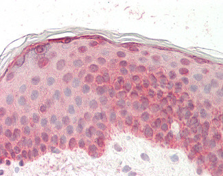 pro-EGF Antibody in Immunohistochemistry (Paraffin) (IHC (P))