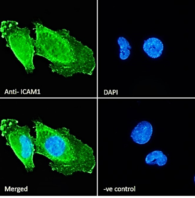 ICAM-1 (CD54) Antibody in Immunocytochemistry (ICC/IF)