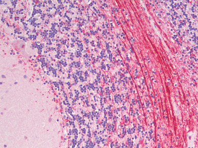 Robo3.2 Antibody in Immunohistochemistry (Paraffin) (IHC (P))