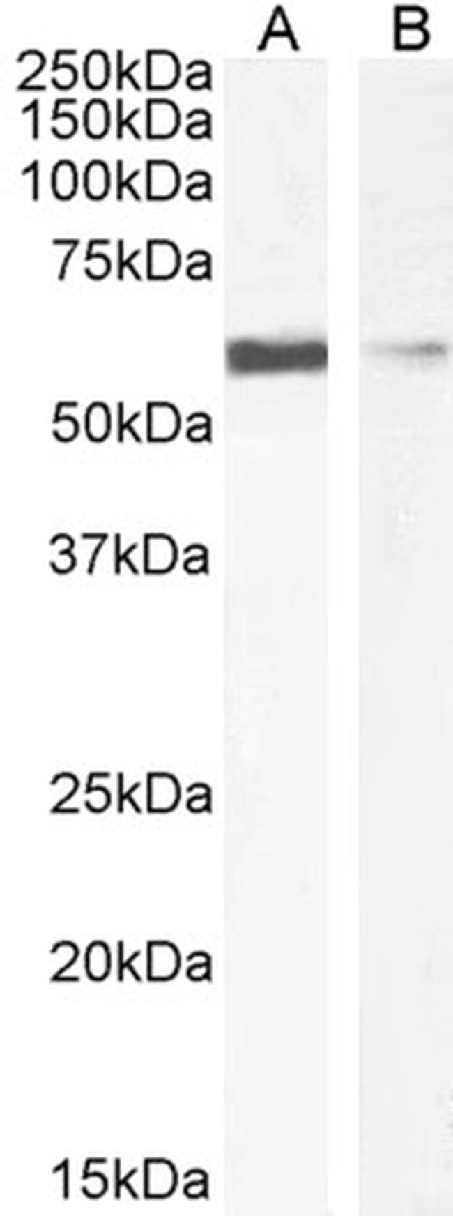IDE Antibody in Western Blot (WB)