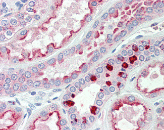 PRAK Antibody in Immunohistochemistry (Paraffin) (IHC (P))