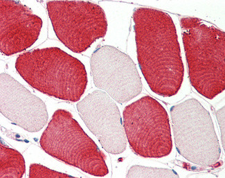 MIA Antibody in Immunohistochemistry (Paraffin) (IHC (P))