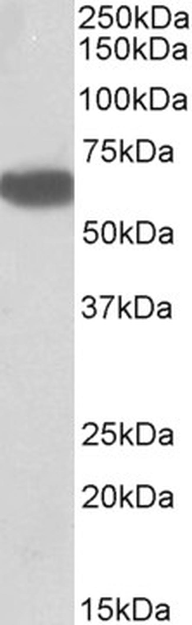 BTD Antibody in Western Blot (WB)