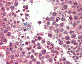 IGFBP-1 Antibody in Immunohistochemistry (Paraffin) (IHC (P))