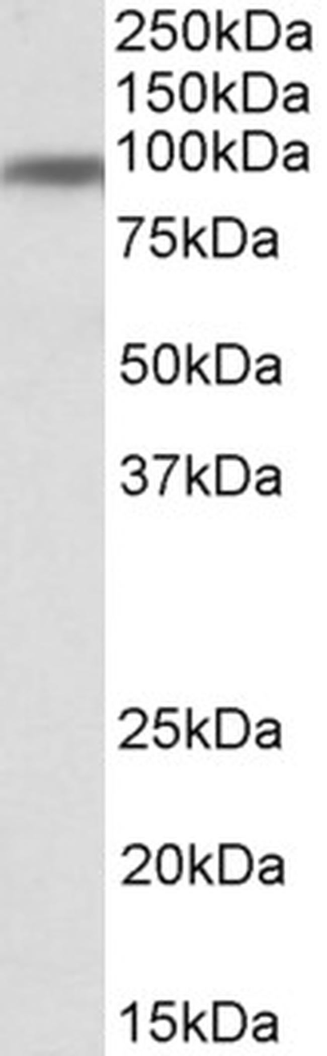 Transferrin Receptor Antibody in Western Blot (WB)