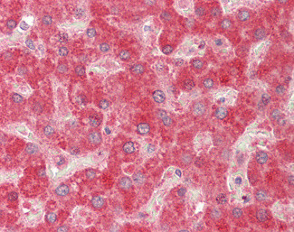 MMP14 Antibody in Immunohistochemistry (Paraffin) (IHC (P))