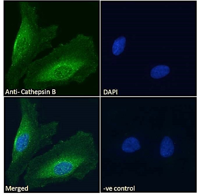 Cathepsin B Antibody in Immunocytochemistry (ICC/IF)