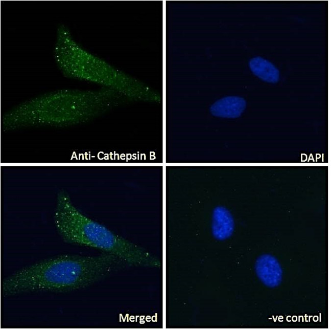 Cathepsin B Antibody in Immunocytochemistry (ICC/IF)