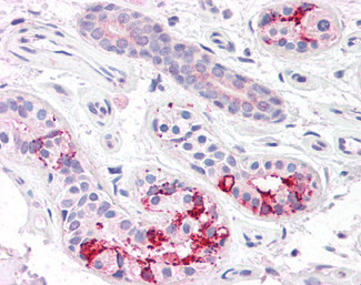 FAM44A Antibody in Immunohistochemistry (Paraffin) (IHC (P))