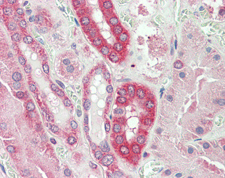 Calpain 1 Antibody in Immunohistochemistry (Paraffin) (IHC (P))