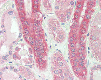 Calpain 1 Antibody in Immunohistochemistry (Paraffin) (IHC (P))