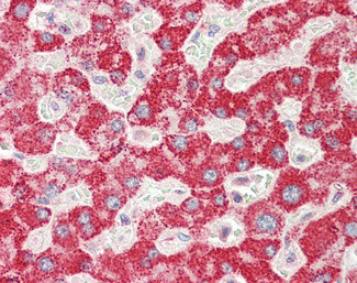 GGT1 Antibody in Immunohistochemistry (Paraffin) (IHC (P))