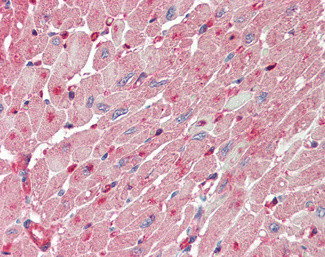 FABP4 Antibody in Immunohistochemistry (Paraffin) (IHC (P))