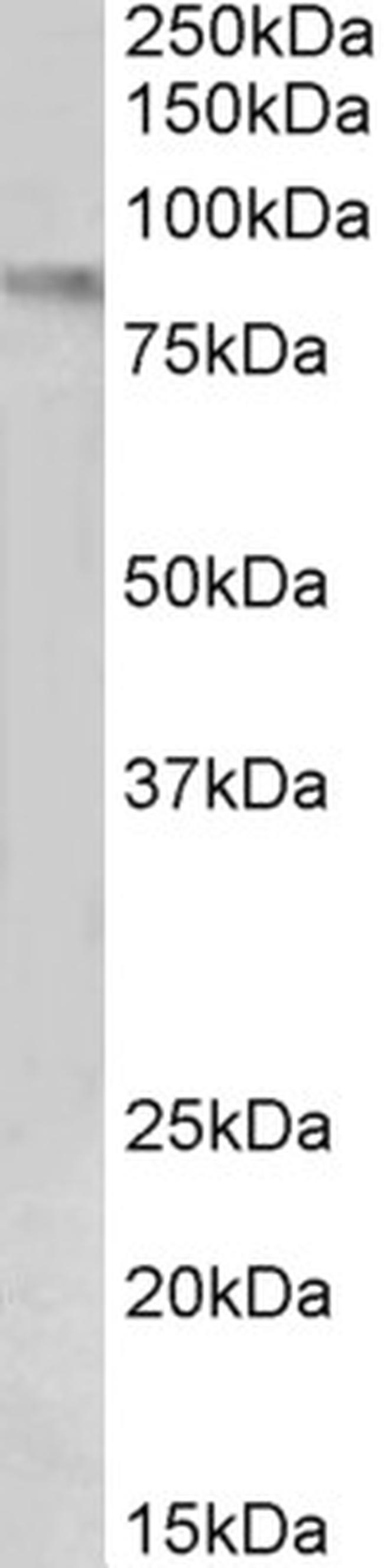VCAM-1 (CD106) Antibody in Western Blot (WB)
