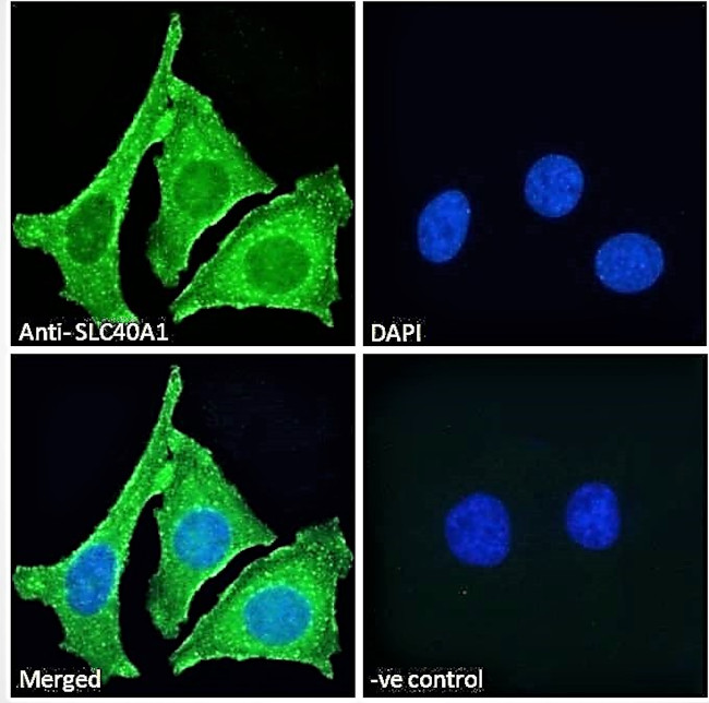 Ferroportin Antibody in Immunocytochemistry (ICC/IF)
