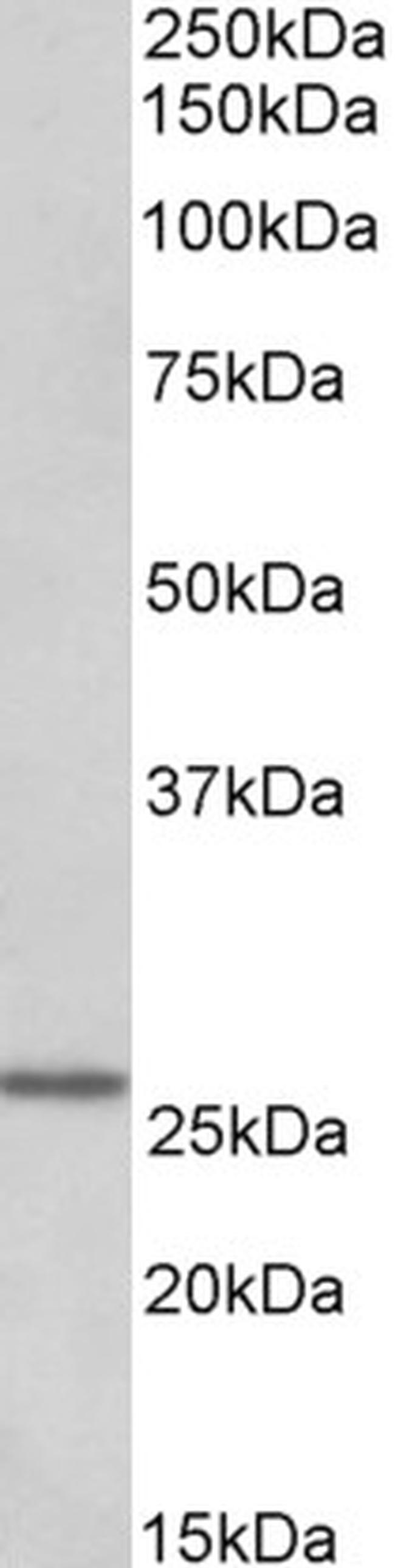 NTAL Antibody in Western Blot (WB)