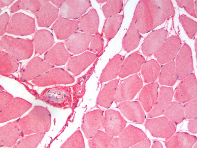 YLAT2 Antibody in Immunohistochemistry (Paraffin) (IHC (P))