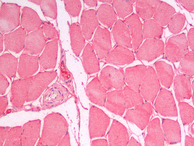 YLAT2 Antibody in Immunohistochemistry (Paraffin) (IHC (P))