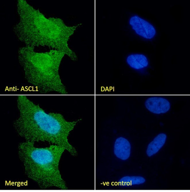 ASCL1 Antibody in Immunocytochemistry (ICC/IF)