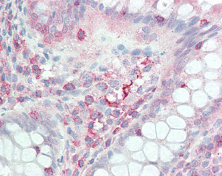 IL17D Antibody in Immunohistochemistry (Paraffin) (IHC (P))
